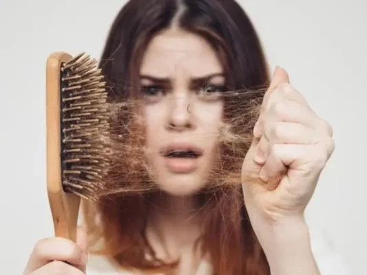 ریزش موی شدید در زنان
