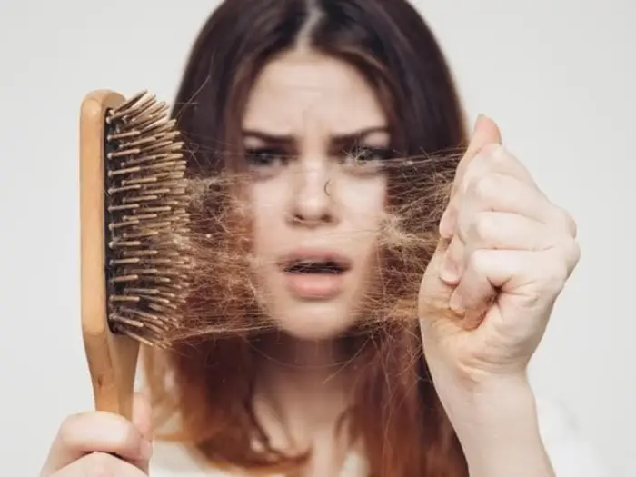 ریزش موی شدید در زنان